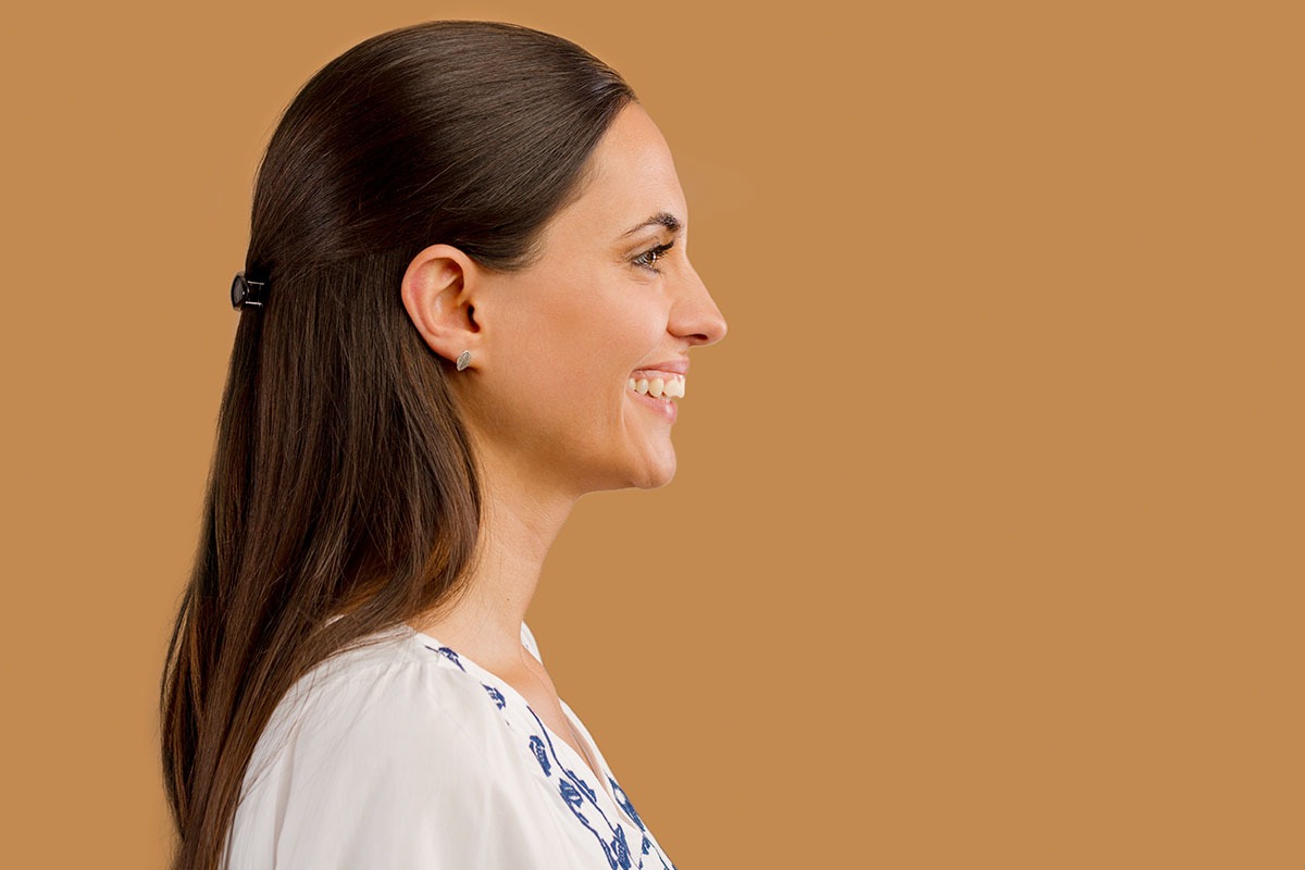 Sobremordida: ¿Qué es y cómo podemos corregirla?