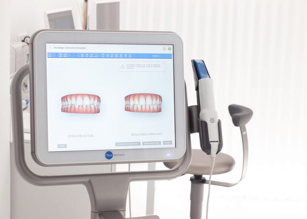 Ortodoncia | Clinica Dental Ramis Gandía iTero - Escáner Invisalign