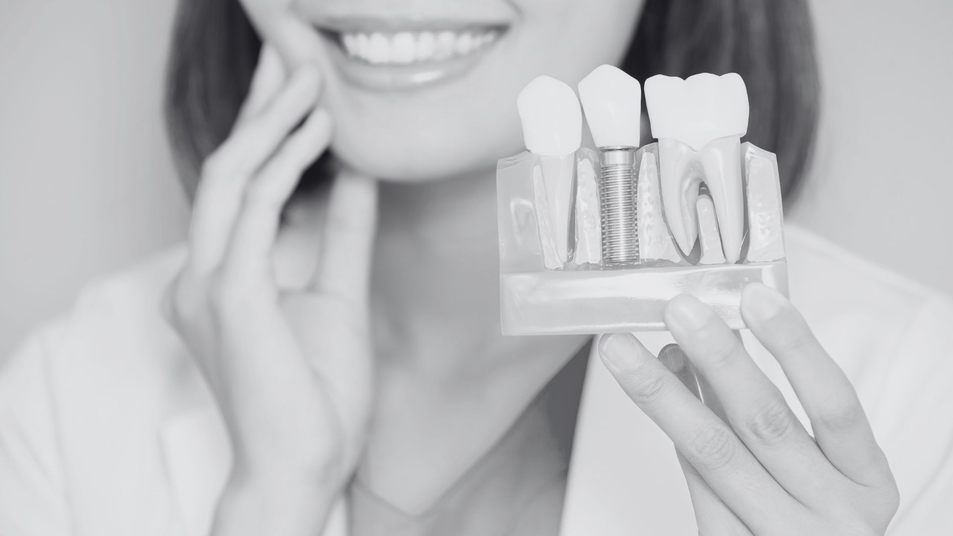 Coronas dentales | Clinica Dental Ramis Gandía Prótesis sobre implantes. Técnica all on 4 y all on 6