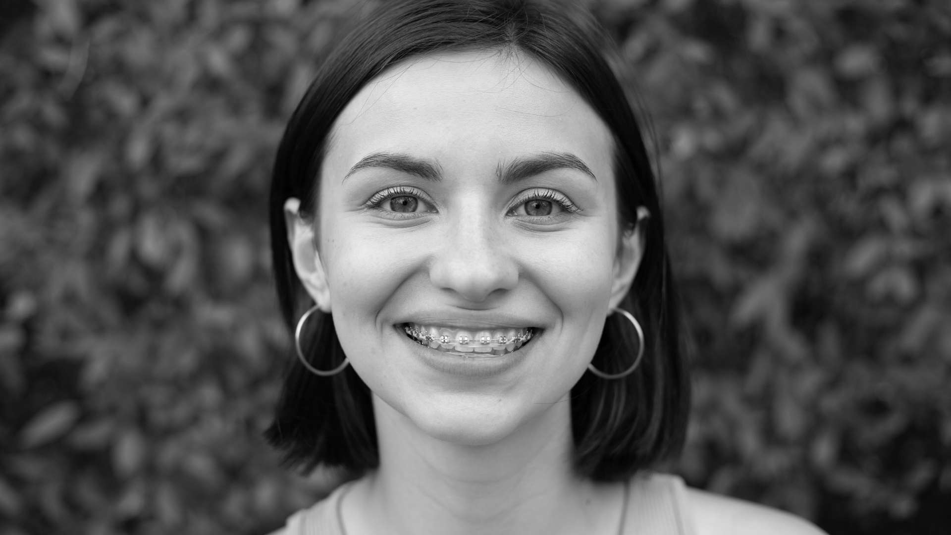 Ortodoncia con brackets | Clinica Dental Ramis Gandía Ramis gandia ortodoncia con brackets