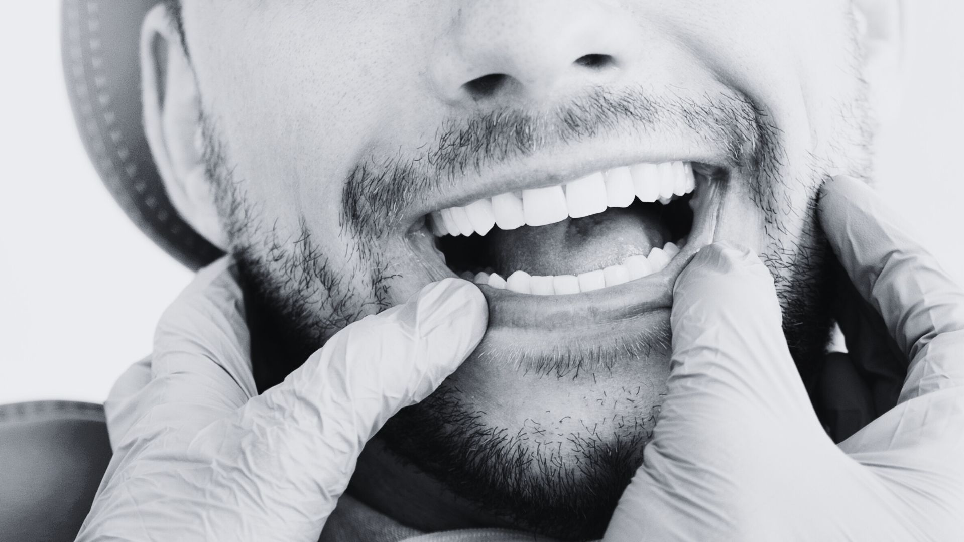 Coronas dentales | Clinica Dental Ramis Gandía Puentes dentales