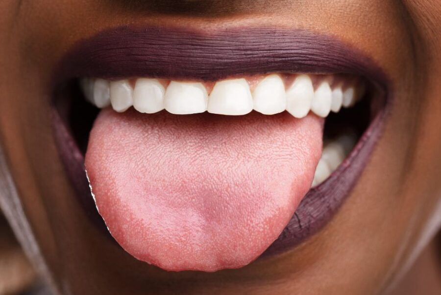 Glositis: Causas, Síntomas, Tratamiento – ZHERSS