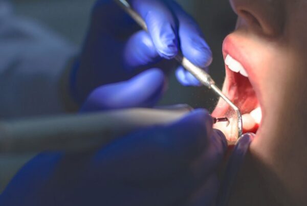 Anquilosis dental: qué es, síntomas y cómo tratarla | Clinica Dental Ramis Gandía Anquilosis dental