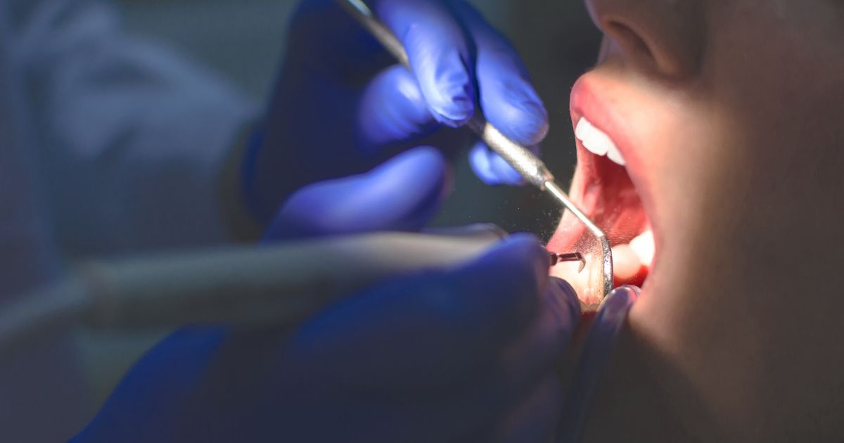 Anquilosis dental: qué es, síntomas y cómo tratarla