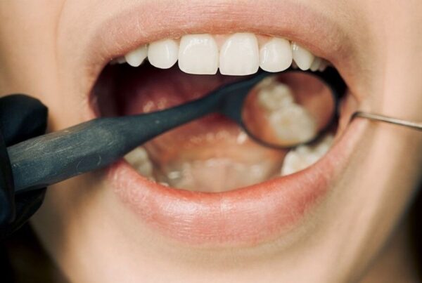 Displasia dentinaria: qué es, causas y tratamiento | Clinica Dental Ramis Gandía displasia dentinaria