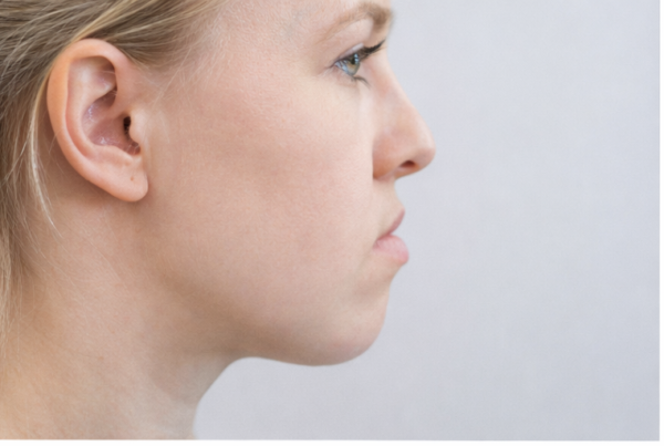 Retrognatia mandibular: perfil facial característico