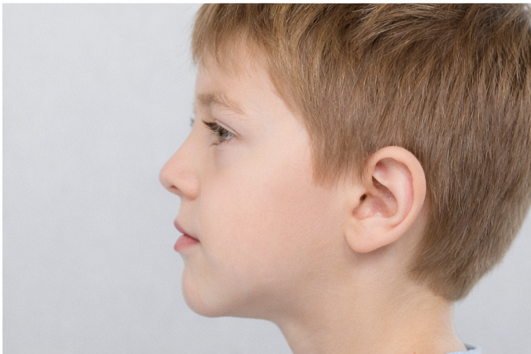 Retrognatia mandibular en niños: detección temprana