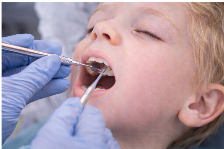 Exploración dental infantil por MIH