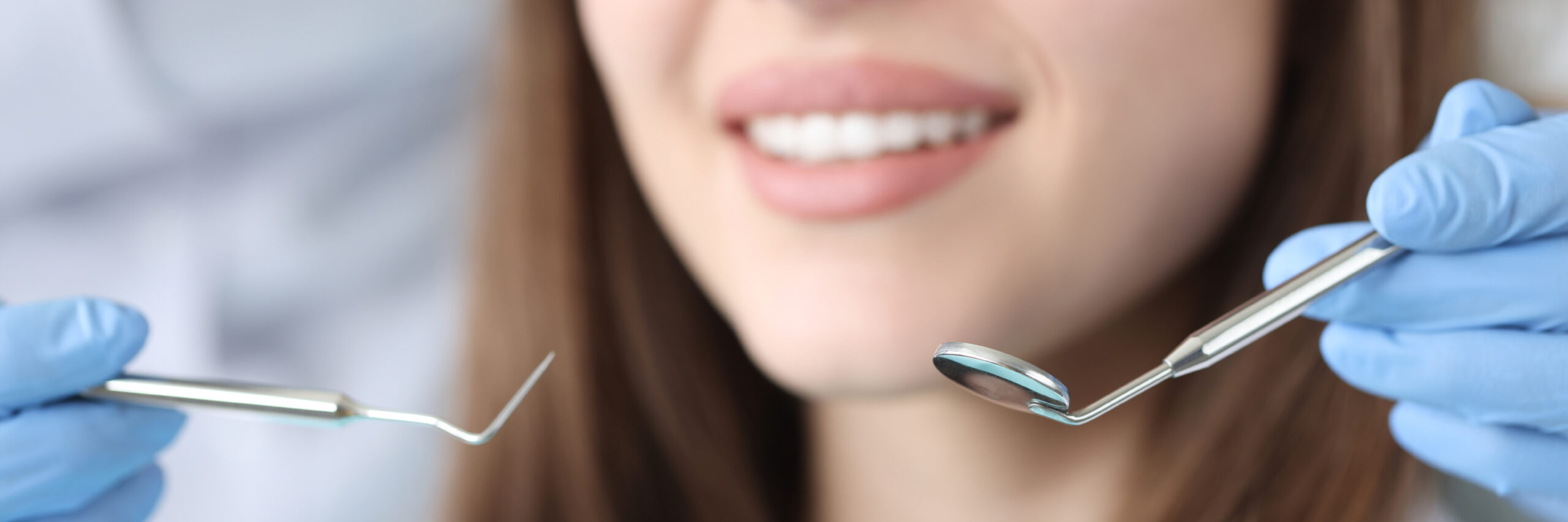 Detalle de triángulos negros dientes en zona anterior de paciente adulto