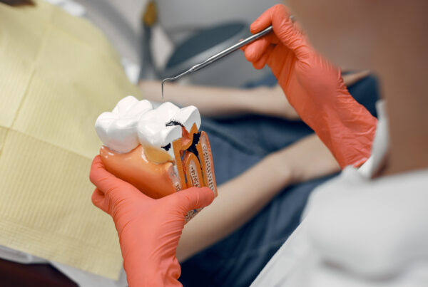 Mantenimiento periimplantario para prevenir periimplantitis en implante dental