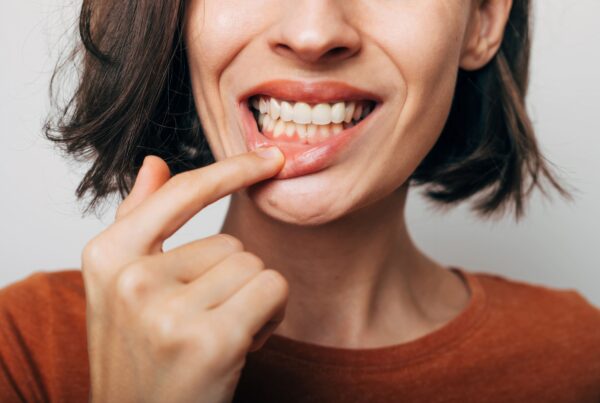 desviación línea media dental