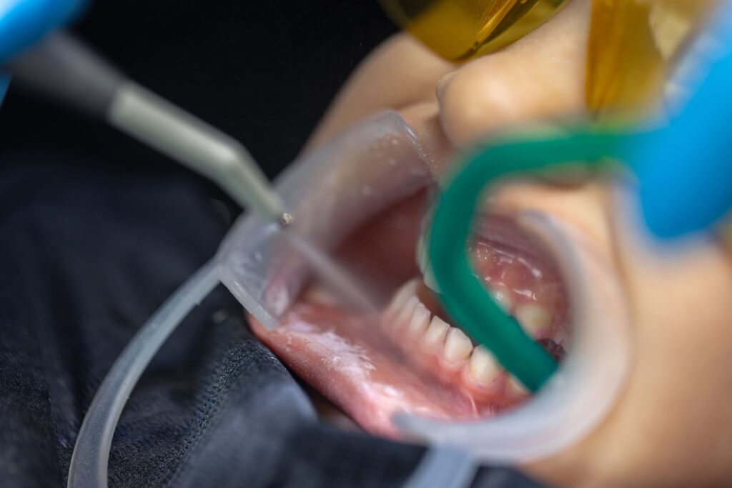 Home | Clinica Dental Ramis Gandía preservación alveolar