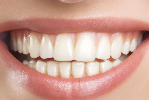 recesión gingival