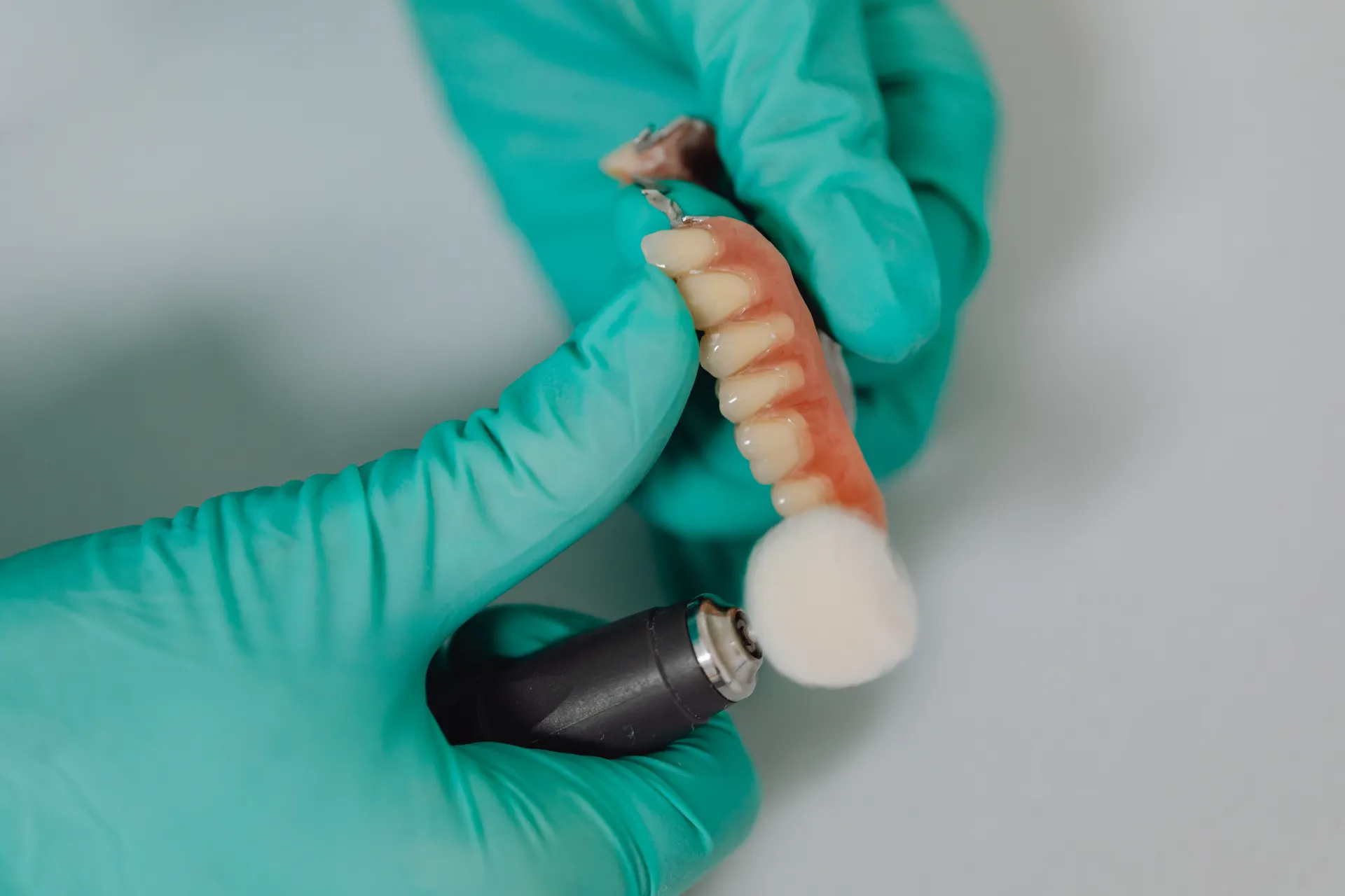 implantes en zona estética