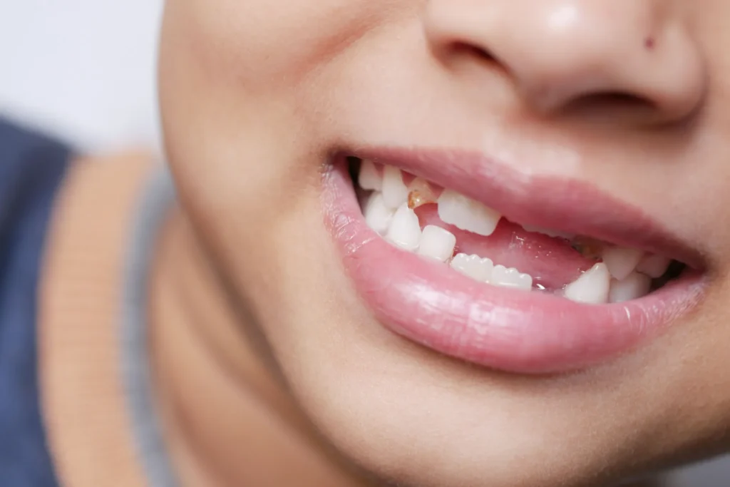 Home | Clinica Dental Ramis Gandía dientes de leche que no se caen