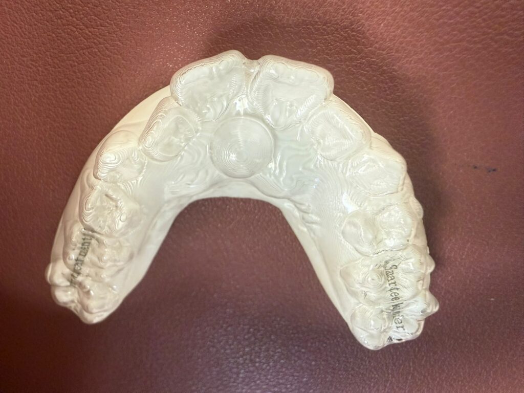 ¿Qué es la deglución atípica o interposición lingual? | Clinica Dental Ramis Gandía